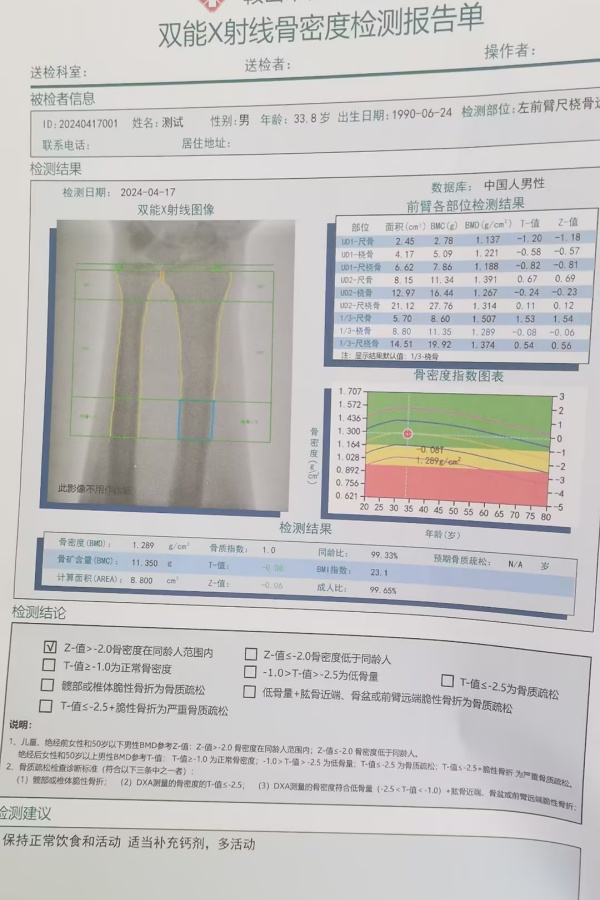 雙能X射線骨密度儀：準(zhǔn)確測(cè)量骨密度，助力骨質(zhì)疏松防治，守護(hù)骨骼健康